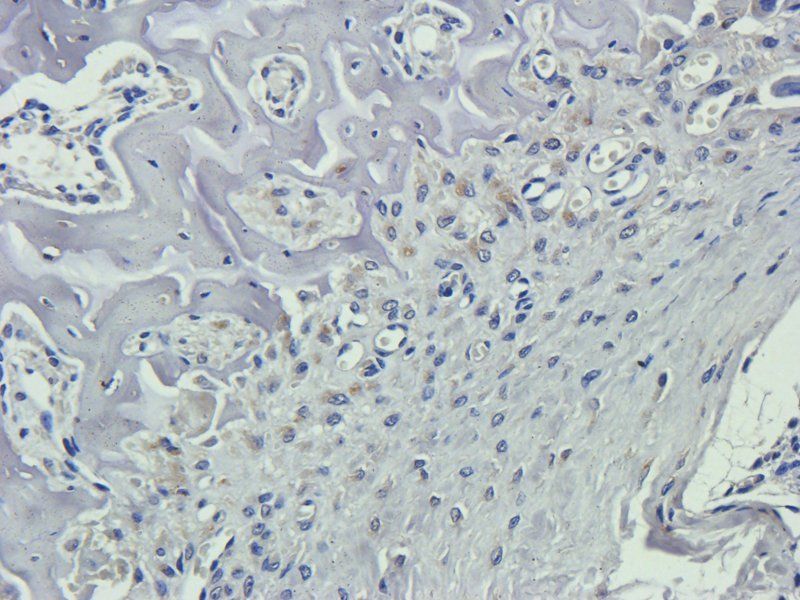 Nestin Rabbit Polyclonal Antibody