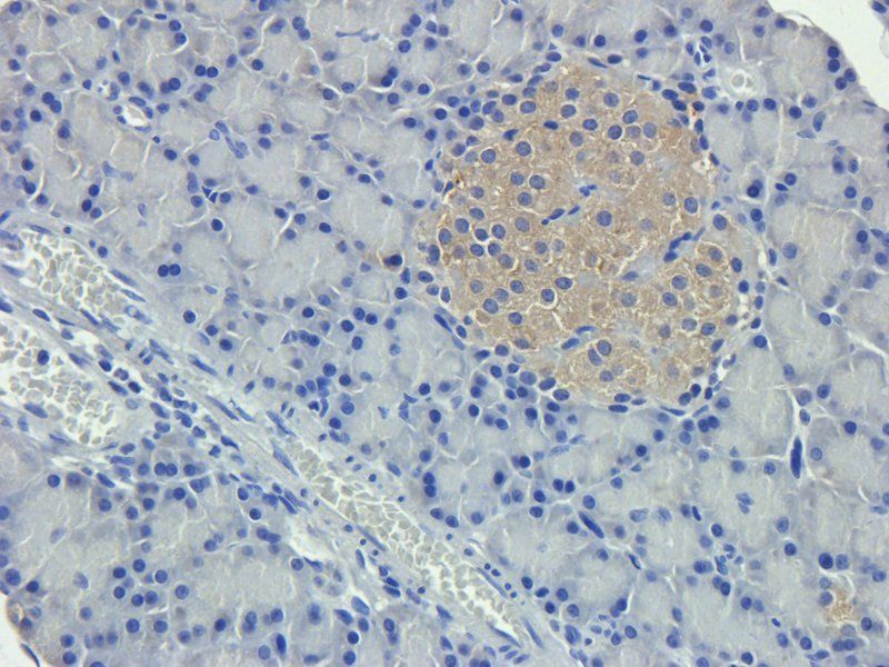 Nestin Rabbit Polyclonal Antibody