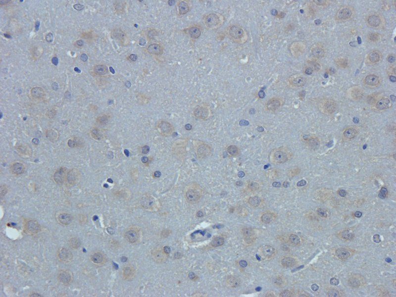 Nestin Rabbit Polyclonal Antibody