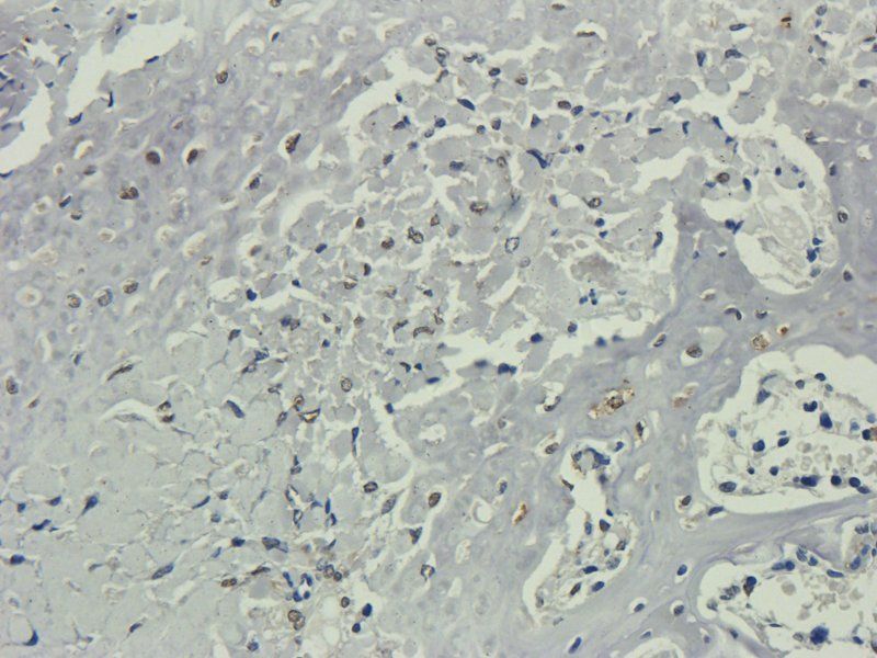 Nestin Rabbit Polyclonal Antibody