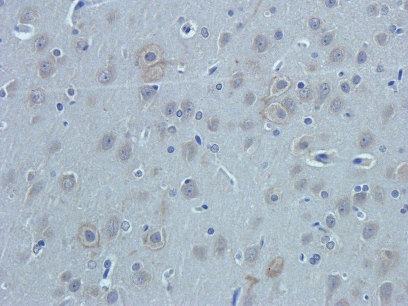 Nestin Rabbit Polyclonal Antibody