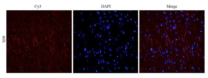 Nestin Rabbit Polyclonal Antibody