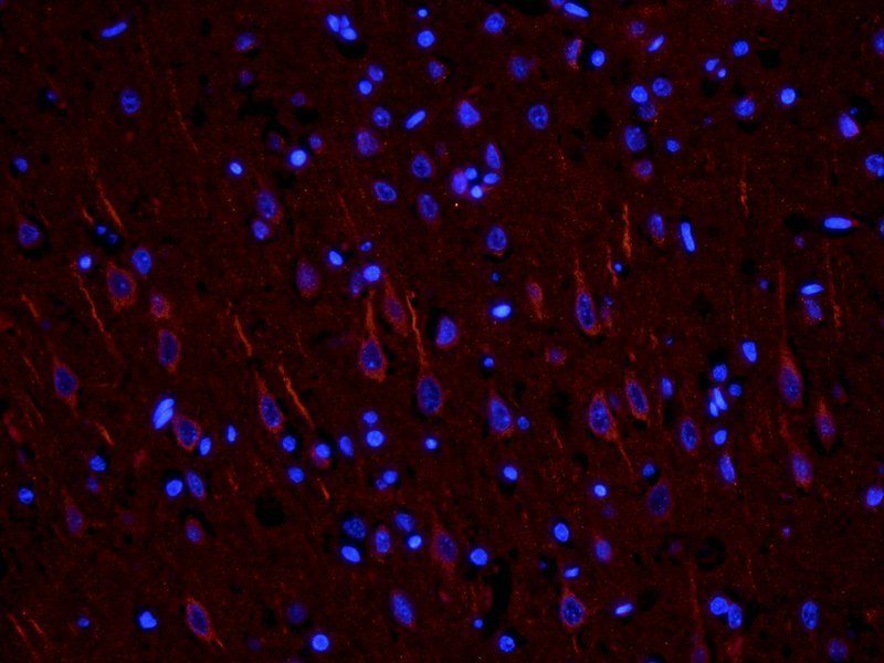 Nestin Rabbit Polyclonal Antibody
