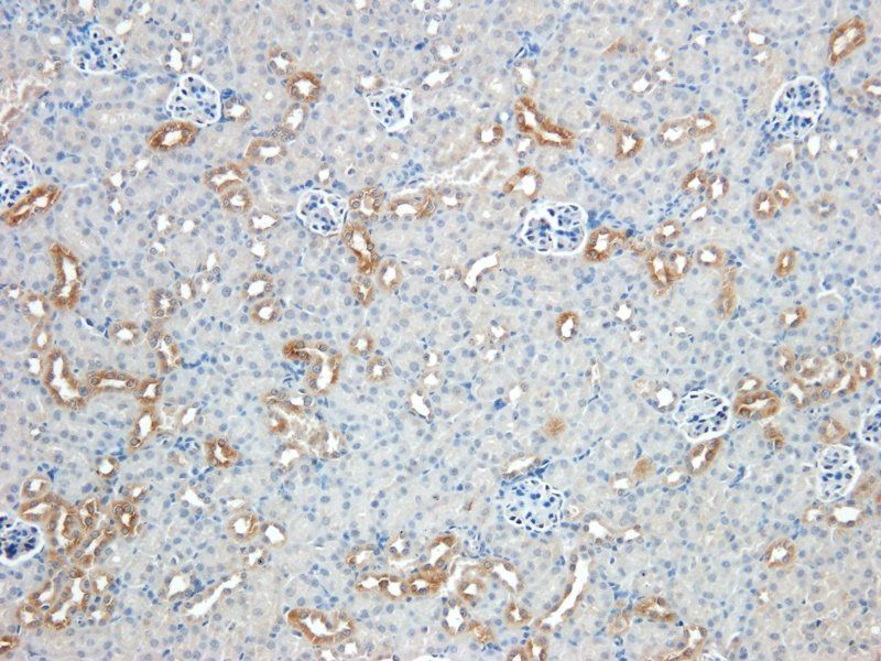 Nestin Rabbit Polyclonal Antibody