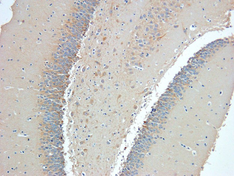 Nestin Rabbit Polyclonal Antibody