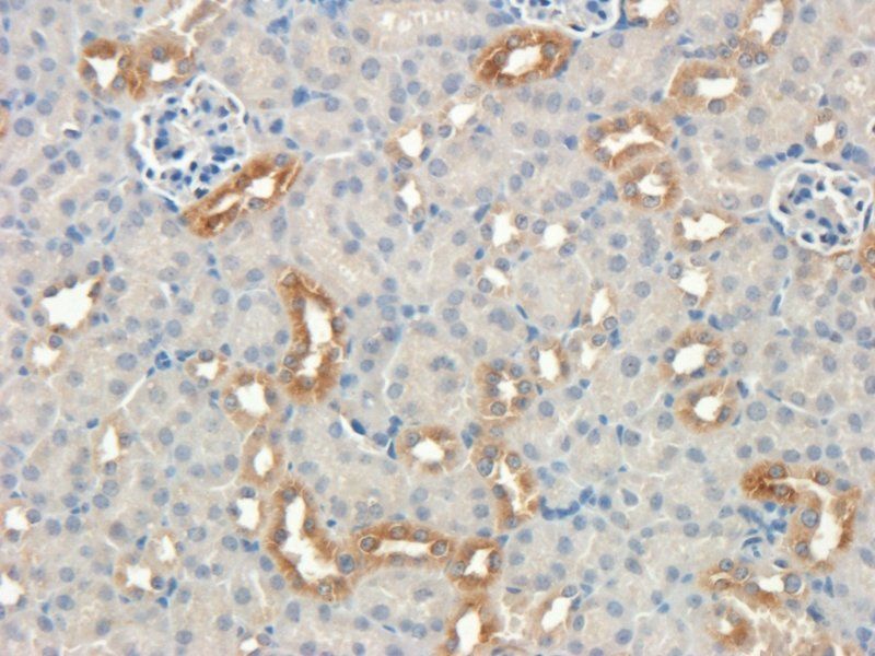 Nestin Rabbit Polyclonal Antibody