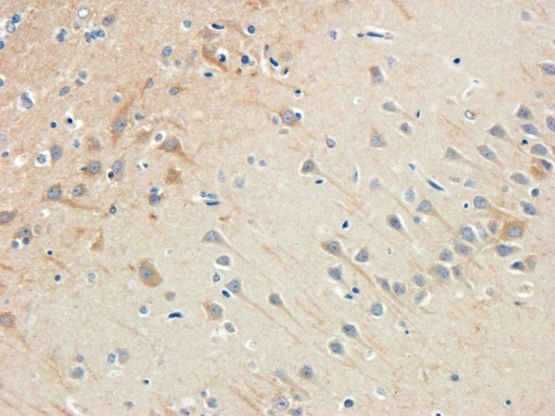 Nestin Rabbit Polyclonal Antibody