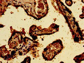 SREBF2 Antibody