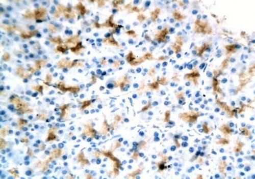 TGF beta 1 Rabbit Polyclonal Antibody