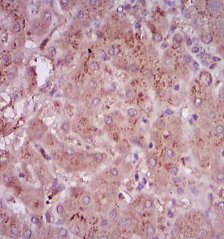 TGF beta 1 Rabbit Polyclonal Antibody