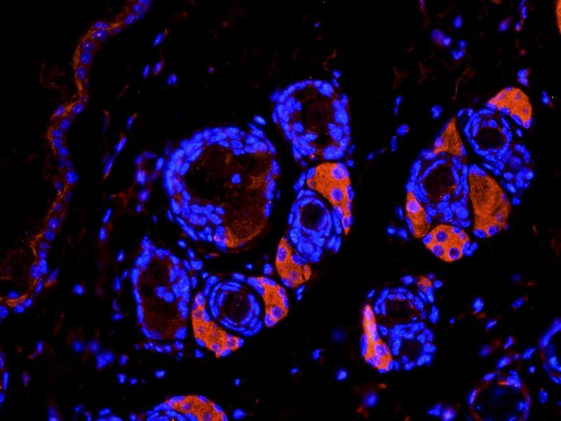 TGF beta 1 Rabbit Polyclonal Antibody