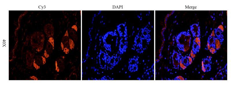 TGF beta 1 Rabbit Polyclonal Antibody