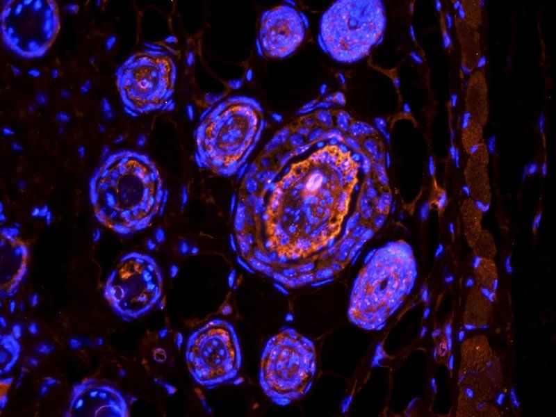 TGF beta 1 Rabbit Polyclonal Antibody