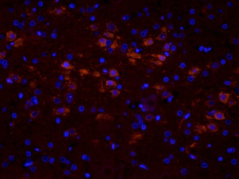 TGF beta 1 Rabbit Polyclonal Antibody