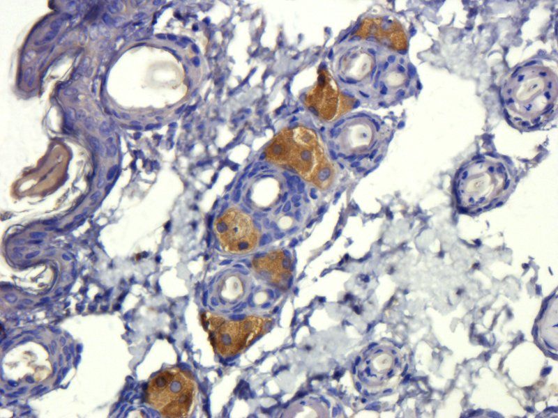 TGF beta 1 Rabbit Polyclonal Antibody