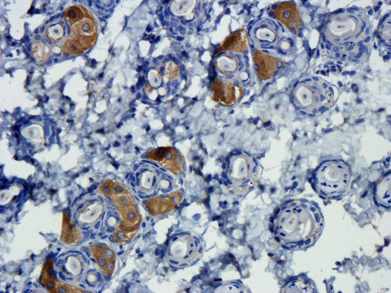 TGF beta 1 Rabbit Polyclonal Antibody