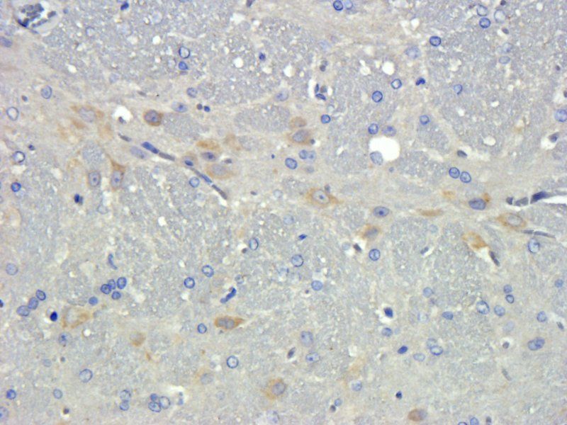 TGF beta 1 Rabbit Polyclonal Antibody