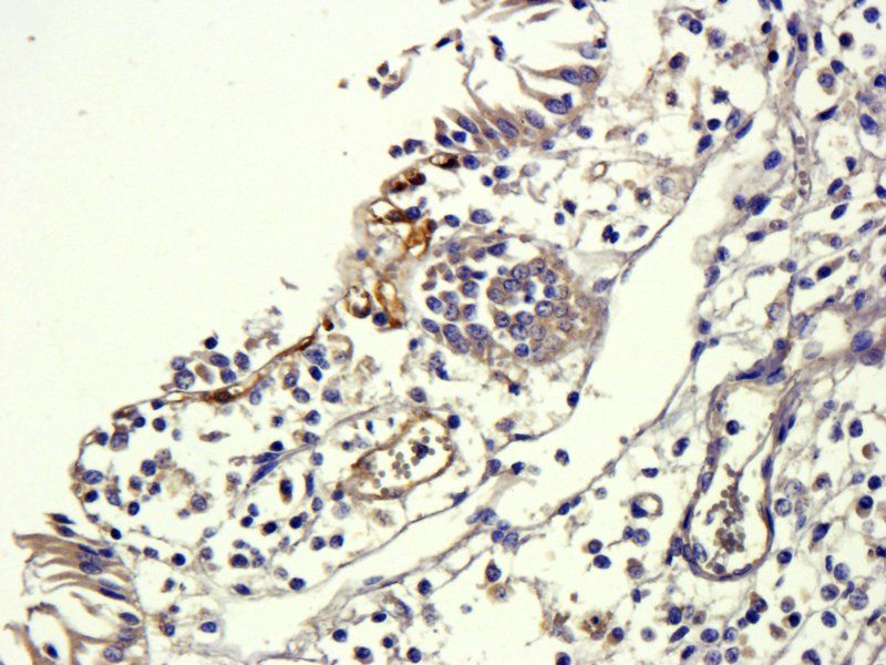 TGF beta 1 Rabbit Polyclonal Antibody