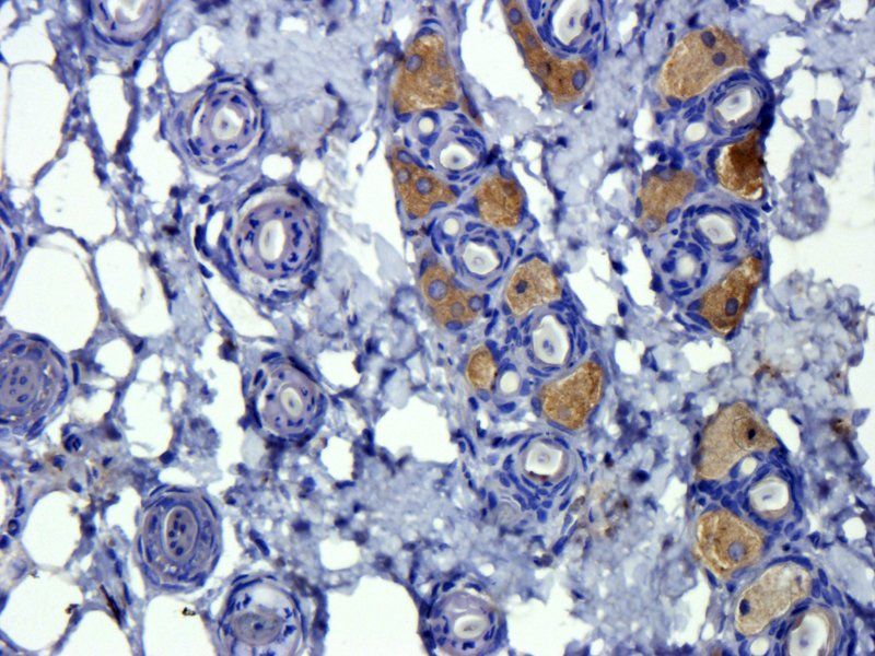 TGF beta 1 Rabbit Polyclonal Antibody