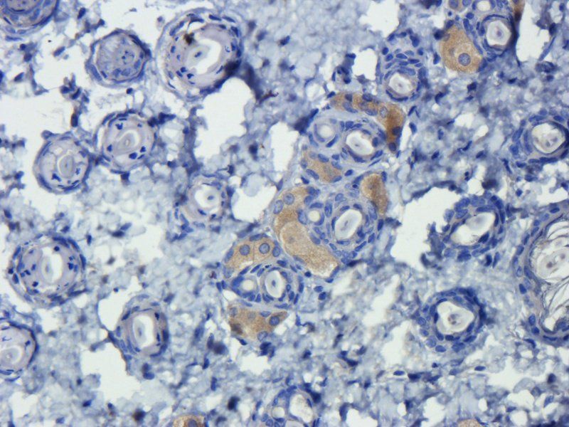 TGF beta 1 Rabbit Polyclonal Antibody