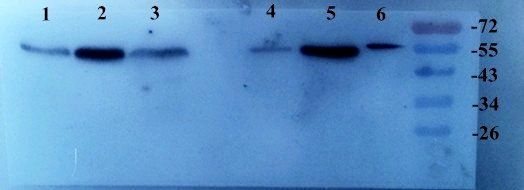 TGF beta 1 Rabbit Polyclonal Antibody