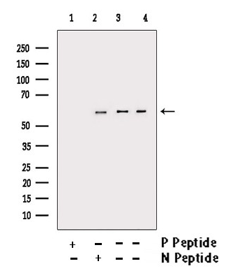 Phospho-pan-AKT1/2/3 (Ser473) Antibody