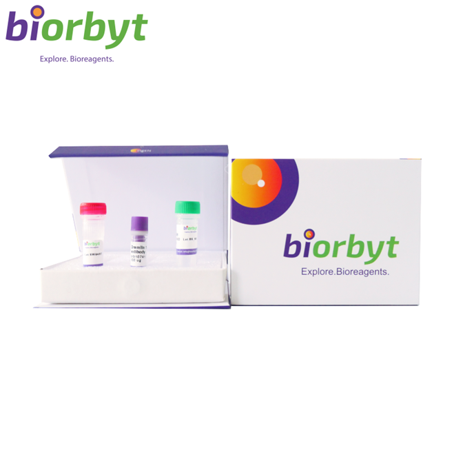 Human IgG4 Antibody (HRP)