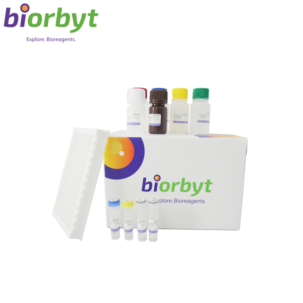 Mouse Hantaan Virus(HV) Antibody ELISA Kit