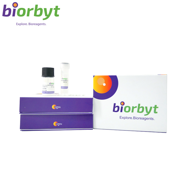 Recombinant Human DNMT3A Protein, N-His