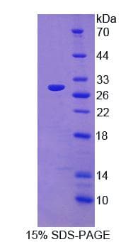 Rat ART4 Protein (Recombinant)