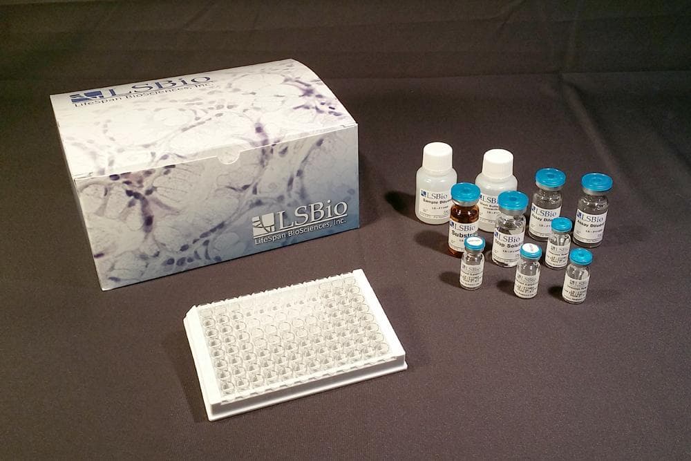 Mouse NODAL ELISA Kit (Custom ELISA)