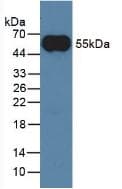 Anti-Mouse IgG Secondary Antibody