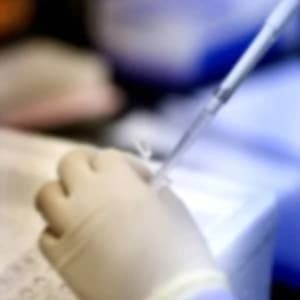 EGFR Phosphorylation Array Testing Service