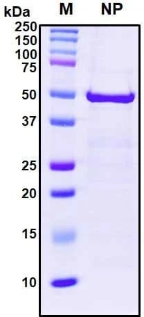 Recombinant SARS-CoV-2 Nucleocapsid Protein