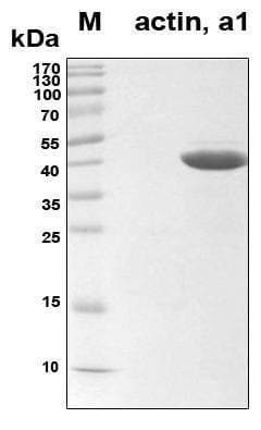 Recombinant Human alpha-actin-1 (ACTA1) Protein, Antigen Grade
