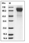 Human RSV (B1) glycoprotein G/RSV-G Protein (His)