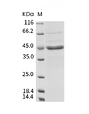 Apolipoprotein L/APOL1 Protein, Human, Recombinant (His)
