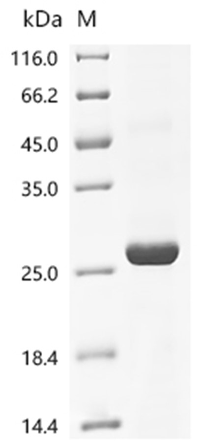IBV (strain M41) Spike glycoprotein (His)