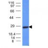 Monoclonal anti Kappa Light Chain (L1C1)