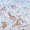 Monoclonal anti Kappa Light Chain (L1C1)