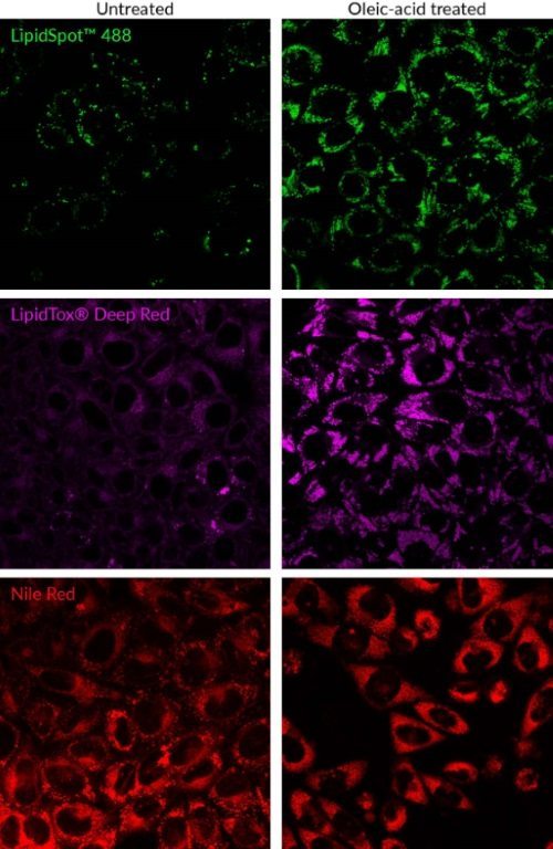 LipidSpot™ Lipid Droplet Stains - Image 5