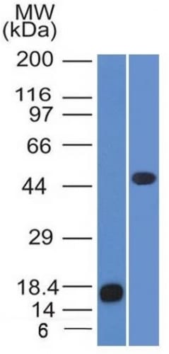Western Blot of recombinant Adipophilin and Jurkat Cell Lysate using Adipophilin Mouse Monoclonal Antibody (ADFP/1365).