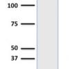 Western Blot Analysis of human HeLa Cell lysate using Ferritin Light Chain Mouse Monoclonal Antibody (FTL/1386).