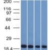 Western Blot of A431 HeLa Liver and Testis Lysate using Ferritin Light Chain Mouse Monoclonal Antibody (FTL/1386).
