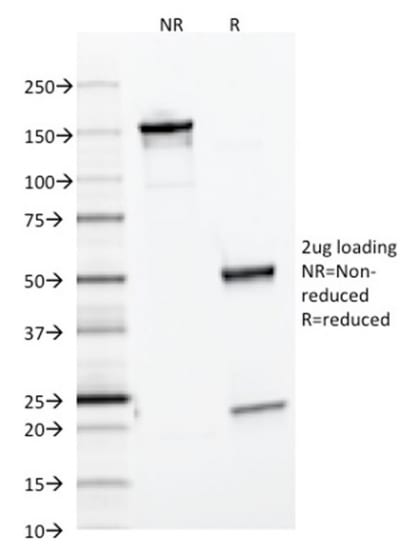 SDS-PAGE Analysis Purified Ferritin Light Chain Mouse Monoclonal Antibody (FTL/1386). Confirmation of Purity and Integrity of Antibody.