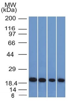 Western Blot of A431 HeLa Liver and Testis Lysate using Ferritin Light Chain Mouse Monoclonal Antibody (FTL/1386).