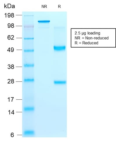 Purified CD44v9 Mouse Recombinant Monoclonal Antibody (rCD44v9/1459). Confirmation of Purity and Integrity of Antibody.