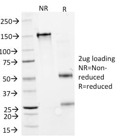 SDS-PAGE Analysis Purified GAD1 (GAD67) Mouse Monoclonal Antibody (GAD1/2391).Confirmation of Purity and Integrity of Antibody.