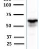 Western Blot Analysis of human Brain tissue lysate using GAD1 (GAD67) Mouse Monoclonal Antibody (GAD1/2391).
