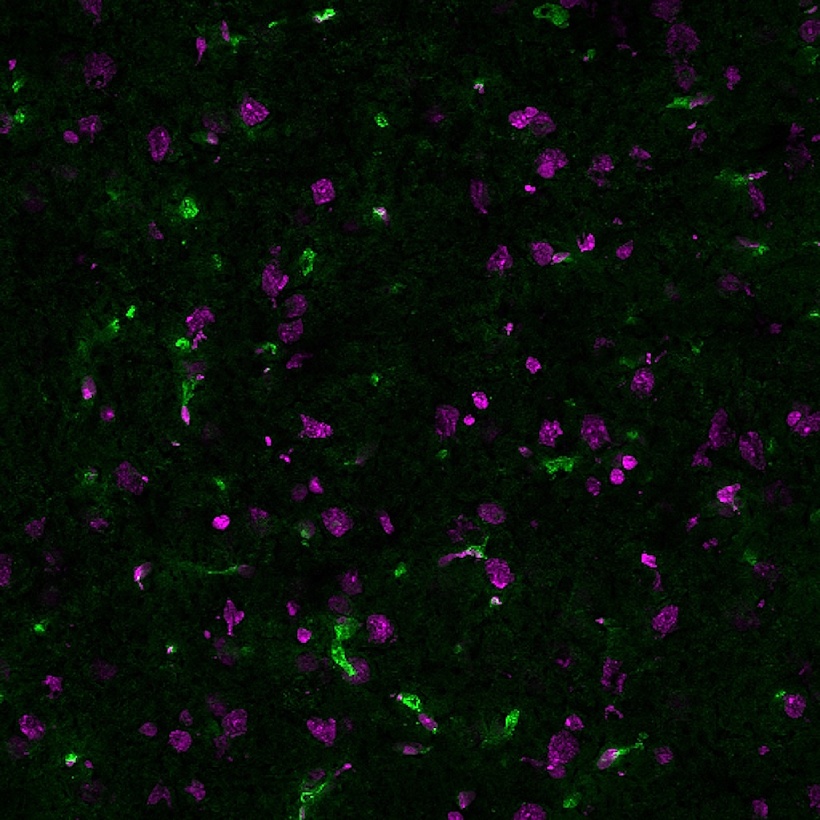 Lycopersicon Esculentum (Tomato) Lectin (LEL, TL) Conjugates - Image 2